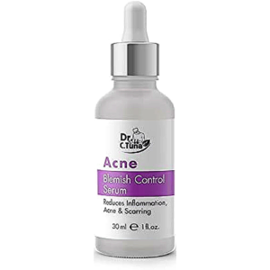 Serum per Aknet